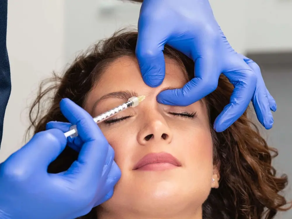 faltenbehandlung-mimikfalten-botox-münchen