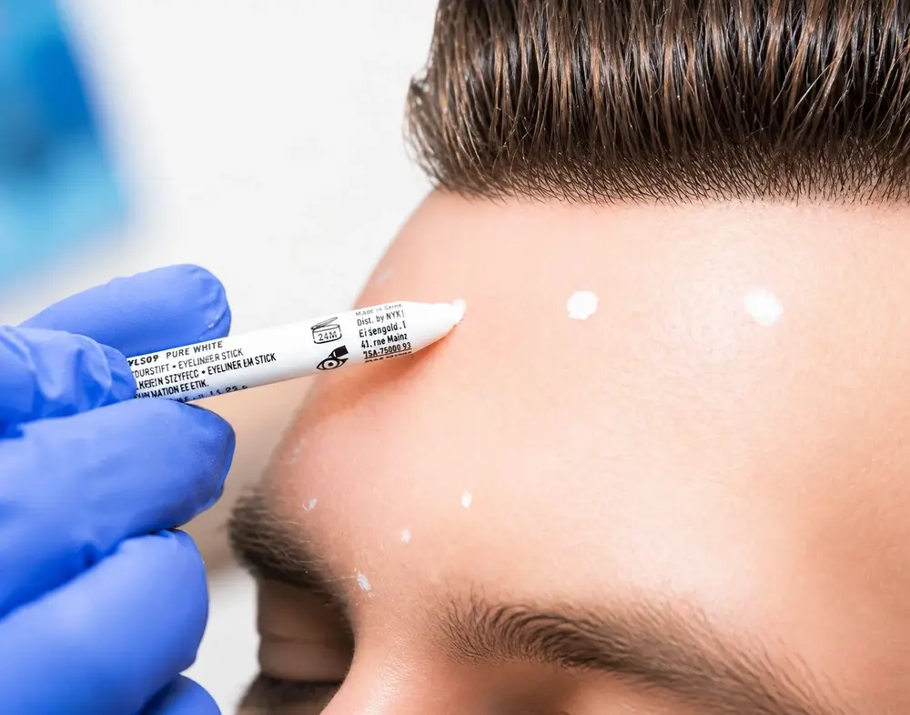 Botox-gegen-migräne